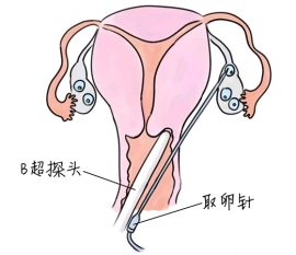 幼儿学画画，无锡捐卵宝宝学画画，学画画的好处，如何学画画