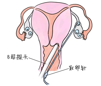 幼儿学画画，无锡捐卵宝宝学画画，学画画的好处，如何学画画